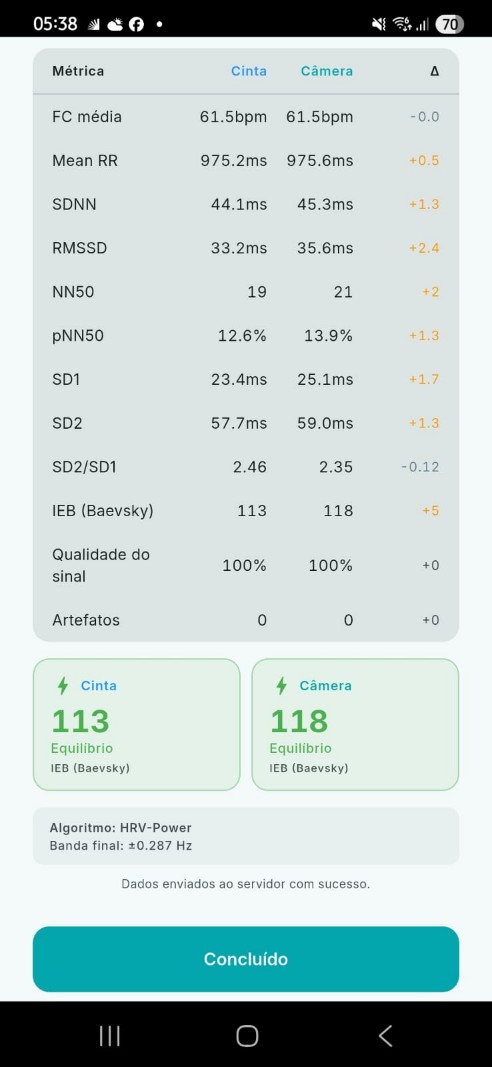 Resultado comparado de VFC entre câmera e cinta cardíaca no HRV-Power em coleta de 1:30